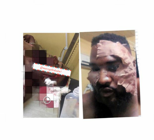 Attack On Wizkid’s Bodyguard Has To Do With His Debt - Court (Graphic Pics)